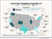 Natural Transplants and Cherry Release Exclusive 2026 Guide to Hair Transplant Cost in the U.S.